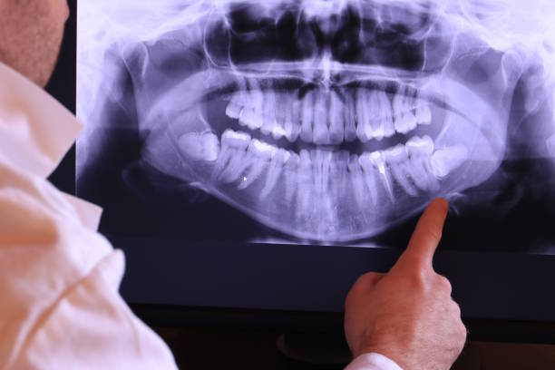 Best Orthodontic Emergency Dentist in Hamilton City, CA