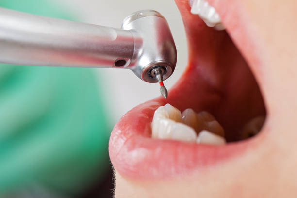 Best Weekend Emergency Dentist in Hamilton City, CA